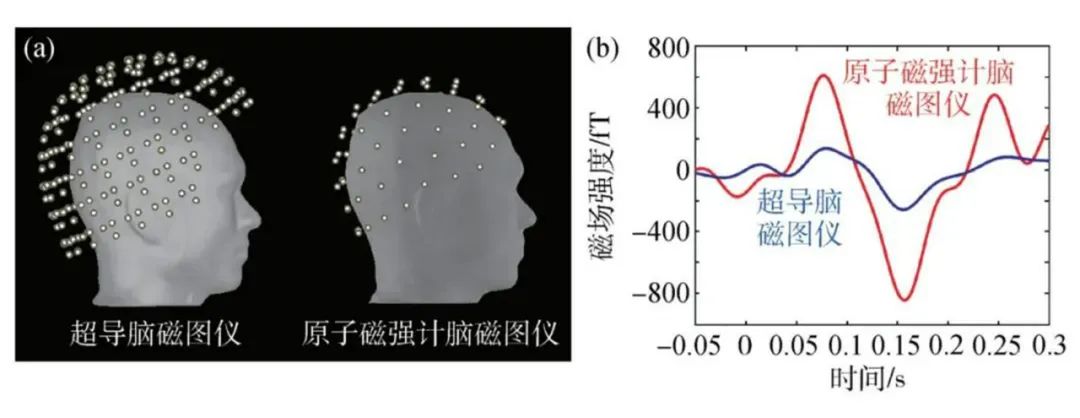 解密大脑活动，脑磁图引领脑科学研究新热点