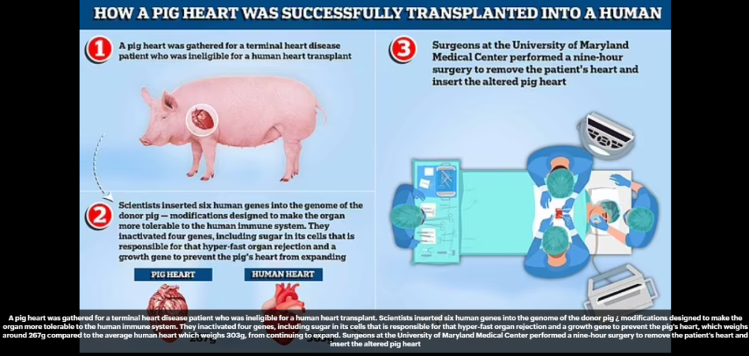 突发！全球首个接受猪心脏移植病患死亡