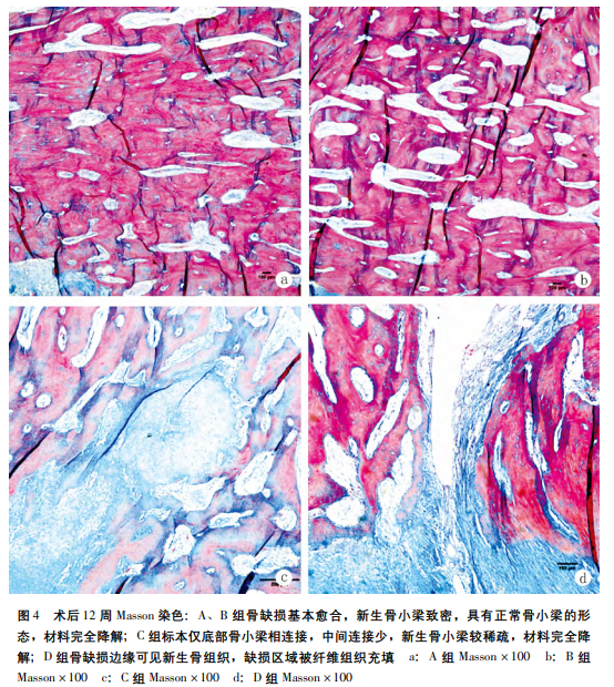 十六年磨一剑，BMP活性生物骨能否颠覆传统骨修复“金标准”？