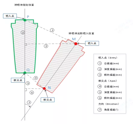 种植体植入精度具体参数定义