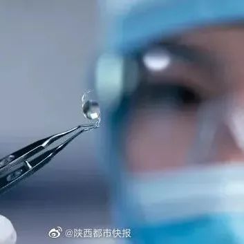 “交联聚烯烃” 人工晶状体进入临床试验