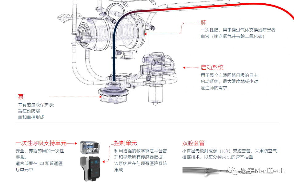 下一代ECMO！呼吸科技企业推出新品